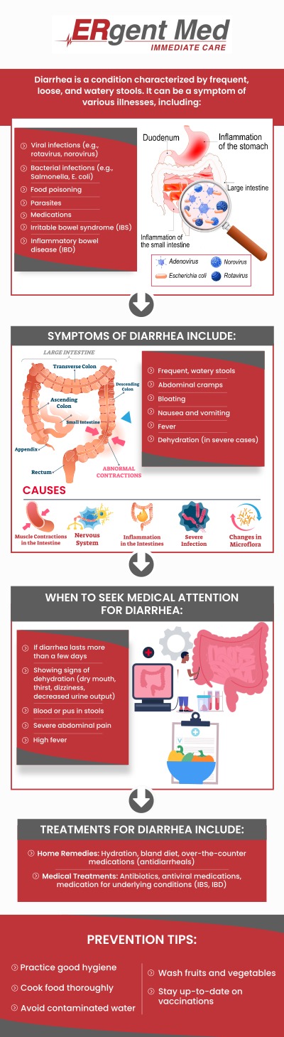 Common questions asked by patients: What causes diarrhea? When should I seek medical attention for diarrhea? How can I prevent dehydration from diarrhea? How long does diarrhea usually last?
If you're experiencing diarrhea, prompt treatment is essential to avoid dehydration and manage symptoms. Dr. Michael Hamm, DO, and the team at ERgent Med Immediate Care in St. Simons Island, GA provide fast and reliable care for diarrhea. Whether it's caused by an infection or digestive issues, we offer treatment options to help you feel better quickly. Trust our dedicated professionals for effective care and advice. For more information, contact us or schedule an appointment online. We are conveniently located at 106 Retreat Village, St Simons Island, GA 31522. We serve patients from St. Simons Island GA, Sea Island GA, Brunswick GA, Dock Junction GA, Club Estates GA, and surrounding areas.