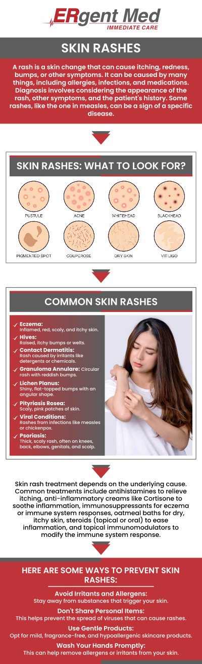Common questions asked by patients: What are the common causes of rashes? When should I see a doctor for a rash? How long do rashes typically last? Where to get treatment for rashes in Brunswick, GA? If you're dealing with a rash and need prompt treatment, ERgent Med Immediate Care in Brunswick, GA, offers care for a variety of skin conditions. Board-certified Dr. Michael Hamm, DO, and our team specialize in diagnosing and treating rashes caused by allergies, infections, skin conditions, and more. We provide tailored treatment plans to relieve symptoms and address the underlying cause of your rash, ensuring fast relief and a quicker recovery. For more information, contact us or schedule an appointment. We are conveniently located at 5248 New Jesup Hwy, Brunswick, GA 31523. We serve patients from Brunswick GA, Dock Junction GA, Sterling GA, Country Club Estates GA, St. Simons Island GA, Darien GA, and surrounding areas.