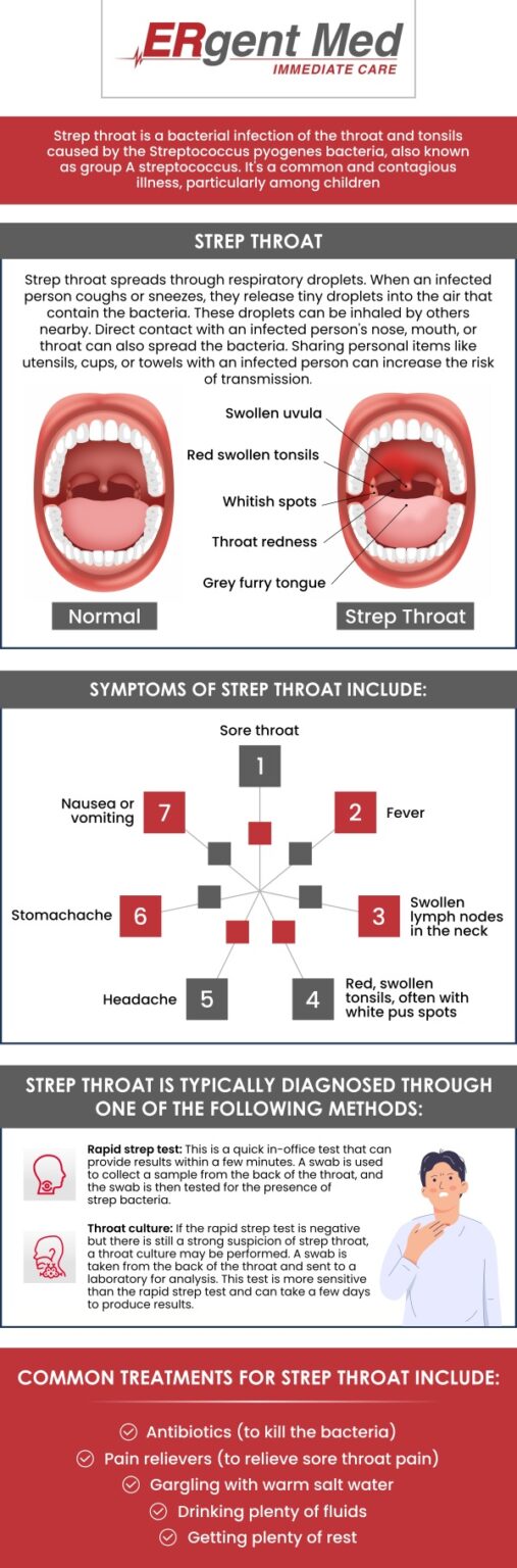 Strep Throat Treatment in St. Simons Island, GA | Dr. Michael