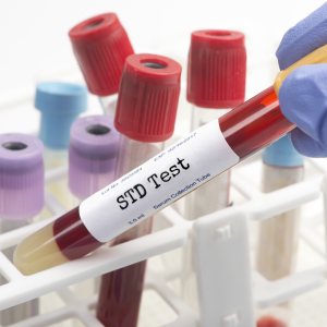 STD Screening in Brunswick, GA and St. Simons Island, GA