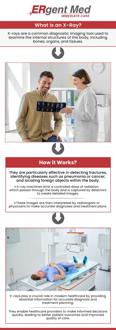 X-rays are a crucial diagnostic tool for assessing injuries, illnesses, and health concerns quickly and accurately. At ERgent Med Immediate Care, Board-certified Dr. Michael Hamm, DO, offers advanced X-ray services to help diagnose a wide range of conditions. Whether you're experiencing pain from an injury, suffering from an illness, or in need of a thorough health check, our state-of-the-art equipment ensures precise results. Our team of medical professionals provides high-quality, timely care tailored to your unique health needs. For more information, contact us or schedule an appointment. We are conveniently located at 5248 New Jesup Hwy, Brunswick, GA 31523.