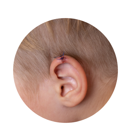 laceration stitched at urgent care